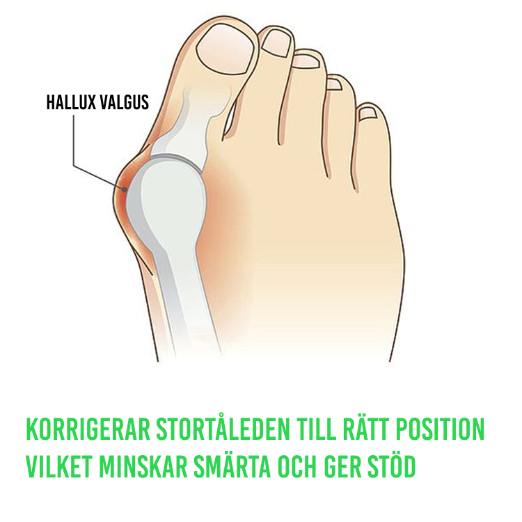 Silikonebeskytter til hallux valgus (2 stk.)