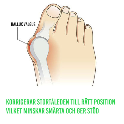 Silikonebeskytter til hallux valgus (2 stk.)