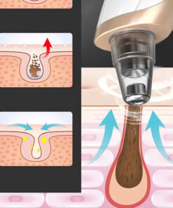 Alternative view of Elektrisk Pormaskborttagare – Uppladdningsbar Porrengörare med 3 sugnivåer