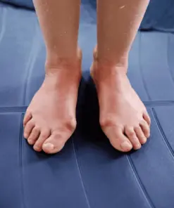 Hallux Valgus