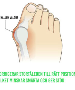 Alternative view of Hallux valgus silikonskydd (2 st)
