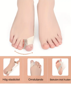taseparator for hallux valgus 2