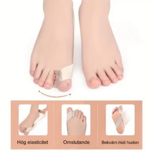 taseparator for hallux valgus 2